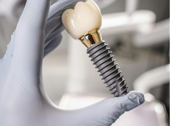What Kind of Dental Treatments Are Available in Jaffna at Prime Smile? Our Services Explained