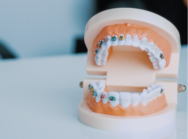 Prime Smile will Open Soon! The Best Dentist in Sri Lanka for Implants